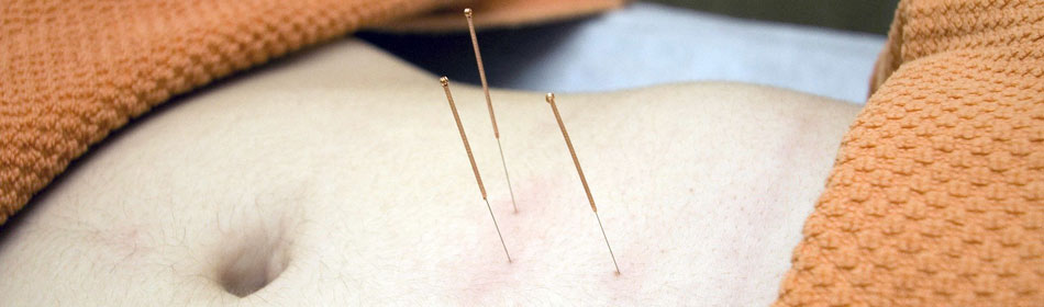Accupuncture, Eastern Healing Arts in the Sellersville, Bucks County PA area